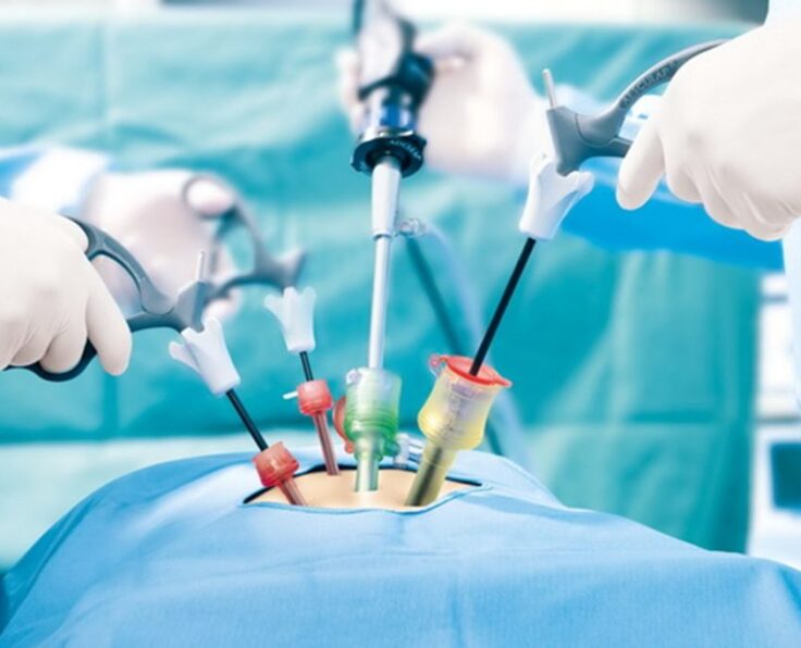 laparoskopikcerrahi1