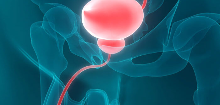 yapaymesaneameliyatınedir